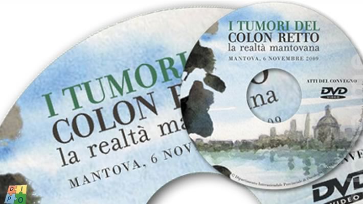 Tumors in colon rectum